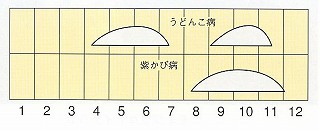 発生消長