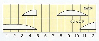 発生消長