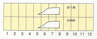 発生消長